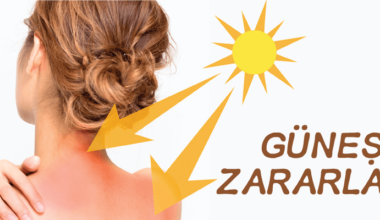 Yaz Aylarında Güneş Işınlarının Sağlığımıza Zararları Nelerdir Yaz Aylarında Güneş Işınlarının Sağlığımıza Zararları Nelerdir