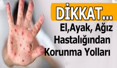 Dikkat Okullar açılırken el ağız ayak hastalığı için ne yapılmalı Dikkat Okullar açılırken el ağız ayak hastalığı için ne yapılmalı